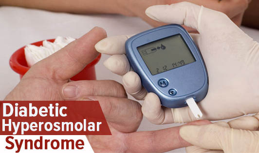Diabetic hyperosmolar syndrome
