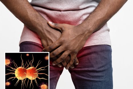 Sexually transmitted diseases (STDs)